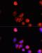 Tyrosinase antibody, LS-C748650, Lifespan Biosciences, Immunofluorescence image 