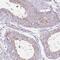 Radial Spoke Head 10 Homolog B antibody, PA5-61904, Invitrogen Antibodies, Immunohistochemistry frozen image 