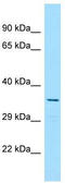 ADP Ribosylation Factor Like GTPase 6 Interacting Protein 4 antibody, TA332344, Origene, Western Blot image 