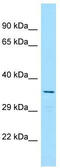 Aip-4 antibody, TA332344, Origene, Western Blot image 