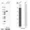 Rho GTPase Activating Protein 26 antibody, NBP1-89732, Novus Biologicals, Western Blot image 