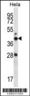 RAD23 Homolog A, Nucleotide Excision Repair Protein antibody, 57-814, ProSci, Western Blot image 