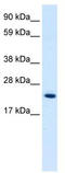 High Mobility Group Box 3 antibody, TA339108, Origene, Western Blot image 
