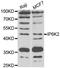 Inositol Hexakisphosphate Kinase 2 antibody, STJ29272, St John