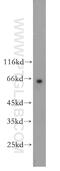 Cell Division Cycle 7 antibody, 17980-1-AP, Proteintech Group, Western Blot image 