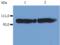 Integrin Subunit Beta 2 antibody, LS-B1849, Lifespan Biosciences, Western Blot image 