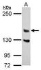 DAZ Interacting Zinc Finger Protein 3 antibody, GTX124220, GeneTex, Western Blot image 