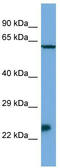 Homeobox protein MSX-3 antibody, TA342282, Origene, Western Blot image 