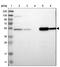Aldehyde Dehydrogenase 9 Family Member A1 antibody, PA5-52756, Invitrogen Antibodies, Western Blot image 