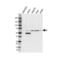 Aldehyde Dehydrogenase 1 Family Member B1 antibody, VPA00300, Bio-Rad (formerly AbD Serotec) , Western Blot image 