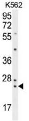 Zymogen Granule Protein 16B antibody, AP53174PU-N, Origene, Western Blot image 