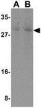 Caspase 7 antibody, GTX31705, GeneTex, Western Blot image 