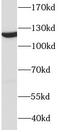 Damage Specific DNA Binding Protein 1 antibody, FNab02285, FineTest, Western Blot image 