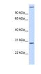 AlkB Homolog 2, Alpha-Ketoglutarate Dependent Dioxygenase antibody, NBP1-56921, Novus Biologicals, Western Blot image 