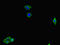 GEM Interacting Protein antibody, LS-C678102, Lifespan Biosciences, Immunofluorescence image 