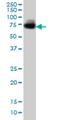 UDP-N-acetylglucosamine: alpha-1,3-D-mannoside beta-1,4-N-acetylglucosaminyltransferase IVa antibody, H00011320-M02, Novus Biologicals, Western Blot image 