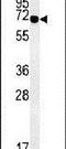 Zinc Finger And BTB Domain Containing 5 antibody, PA5-25225, Invitrogen Antibodies, Western Blot image 