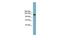 ASXL Transcriptional Regulator 2 antibody, GTX44956, GeneTex, Western Blot image 