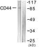 CD44 antibody, LS-C198763, Lifespan Biosciences, Western Blot image 