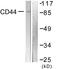 CD44 antibody, LS-C198763, Lifespan Biosciences, Western Blot image 