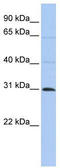 Methyltransferase Like 11B antibody, TA331031, Origene, Western Blot image 