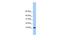 Trafficking Protein Particle Complex 6B antibody, GTX45551, GeneTex, Western Blot image 