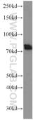 Beta-Secretase 1 antibody, 12807-1-AP, Proteintech Group, Western Blot image 