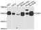 Cannabinoid Receptor 1 antibody, abx126868, Abbexa, Western Blot image 