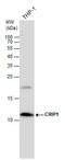 Cysteine Rich Protein 1 antibody, GTX131195, GeneTex, Western Blot image 