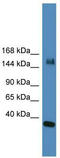 Lysine Demethylase 6A antibody, TA345322, Origene, Western Blot image 