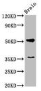 Acetylcholine Receptor antibody, LS-C285478, Lifespan Biosciences, Western Blot image 