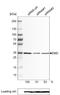 Emerin antibody, NBP2-52877, Novus Biologicals, Western Blot image 