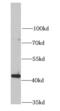 Jumonji Domain Containing 6, Arginine Demethylase And Lysine Hydroxylase antibody, FNab04442, FineTest, Western Blot image 