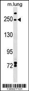 Inverted Formin, FH2 And WH2 Domain Containing antibody, 59-358, ProSci, Western Blot image 