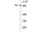 RB Transcriptional Corepressor 1 antibody, LS-C176634, Lifespan Biosciences, Western Blot image 
