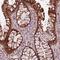 Sorcin antibody, NBP2-57990, Novus Biologicals, Immunohistochemistry frozen image 