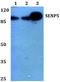 SUMO Specific Peptidase 5 antibody, A08574-1, Boster Biological Technology, Western Blot image 