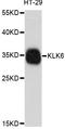 Kallikrein Related Peptidase 6 antibody, abx126064, Abbexa, Western Blot image 