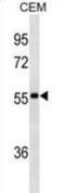 Immunoglobulin Heavy Constant Alpha 1 antibody, abx025522, Abbexa, Western Blot image 