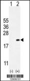 Cyclin Dependent Kinase Inhibitor 2C antibody, 55-525, ProSci, Western Blot image 