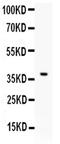 CD86 antibody, PA5-79007, Invitrogen Antibodies, Western Blot image 