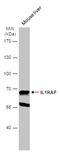 Interleukin 1 Receptor Accessory Protein antibody, GTX104513, GeneTex, Western Blot image 