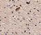 Sprouty Related EVH1 Domain Containing 1 antibody, NBP2-81927, Novus Biologicals, Immunohistochemistry paraffin image 