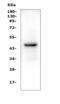 Paired Box 5 antibody, M00669-2, Boster Biological Technology, Western Blot image 