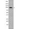 Forkhead Box O3 antibody, abx215458, Abbexa, Western Blot image 