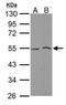 Mixed Lineage Kinase Domain Like Pseudokinase antibody, PA5-34733, Invitrogen Antibodies, Western Blot image 