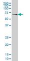 Interleukin 1 Receptor Associated Kinase 3 antibody, H00011213-M01, Novus Biologicals, Western Blot image 