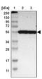 G Protein Subunit Alpha 13 antibody, NBP1-89810, Novus Biologicals, Western Blot image 