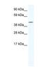 Iroquois Homeobox 6 antibody, NBP1-80245, Novus Biologicals, Western Blot image 