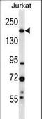 UDP-Glucose Glycoprotein Glucosyltransferase 1 antibody, LS-C160415, Lifespan Biosciences, Western Blot image 